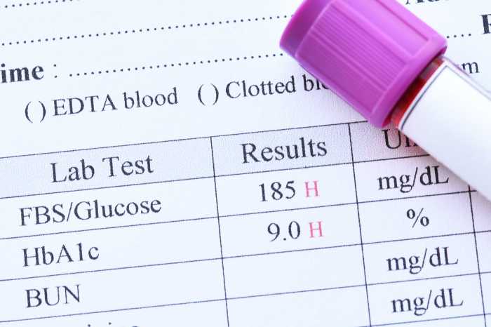 How to interpret results from diabetes screenings