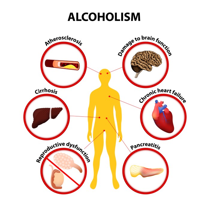 Importance of avoiding smoking and excessive alcohol for bone health